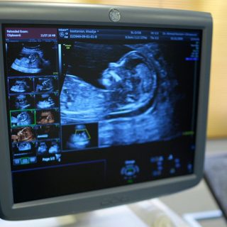 photo_5904559015650774138_y